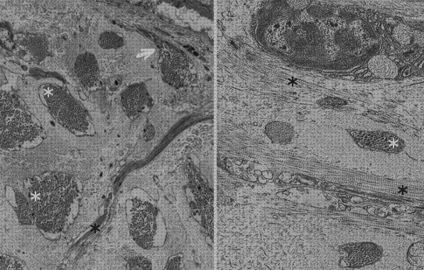 Las mejores marcas de microscopio electrónico matriu extracel lular