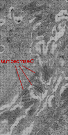 Las mejores desmosomas microscopio electronico membrana desmosomas