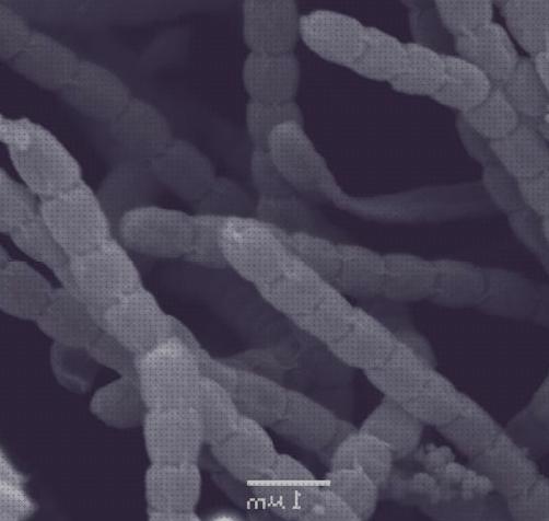 33 Mejores microscopios electronicos microorganismos