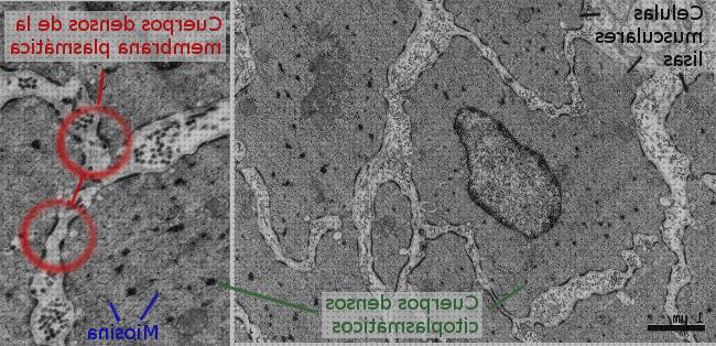 Las mejores electrónicos microscopios microscopio electrónico musculo