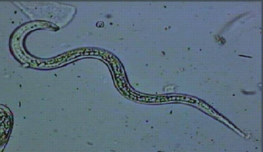 Las mejores microscopio electronico nematodos