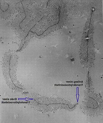 Las mejores ribosomas microscopio electronico nucleo ribosomas