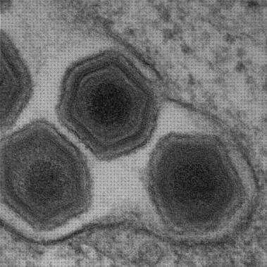 Análisis de los 14 mejores Microscopios Electronicos Pestes Porcina Africanas