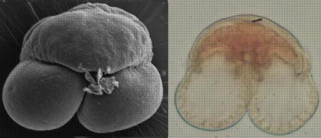 Las mejores electrónicos microscopios microscopio electronico polen