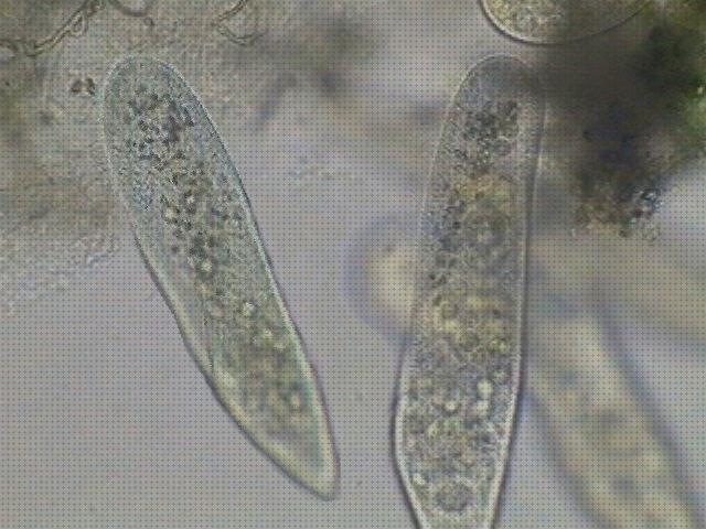 Los 29 Mejores microscopios electronicos protozoos