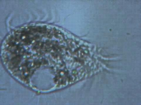 Las mejores microscopio electronico protozoos