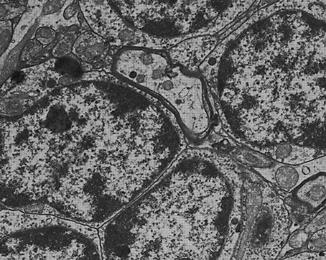 Las mejores marcas de microscopio electronico sinapsis química