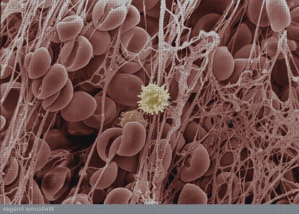 Las mejores microscopio electronico teijdos