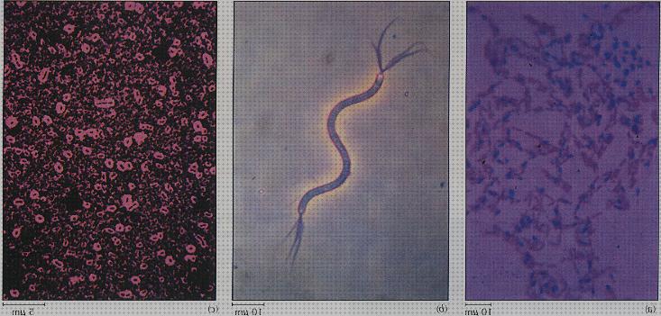 Los mejores 21 Microscopios Electrónicos Tincion Con Metales Pesados