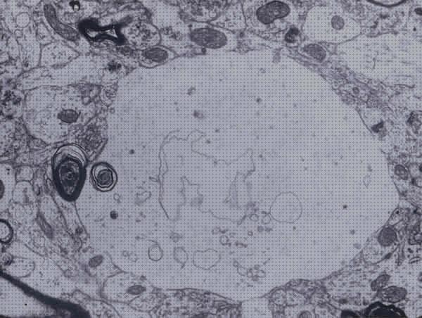 31 Mejores microscopios electronicos vacuolas a la venta