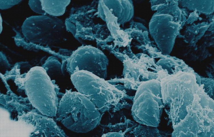 Las mejores semejanzas microscopio electronico y optico semejanzas