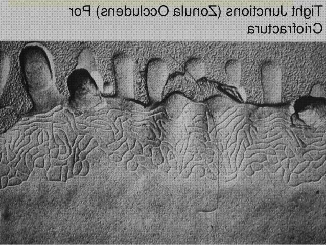 Las mejores marcas de microscopio electronico zonula occludens