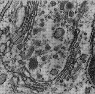 Las mejores marcas de microscopio electrónico citosol