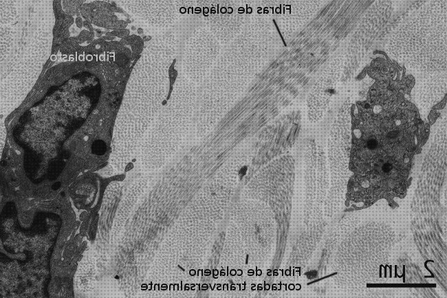 ¿Dónde poder comprar microscopio electrónico fibrocitos?