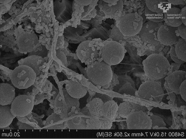 Las mejores marcas de microscopio electrónico levaduras