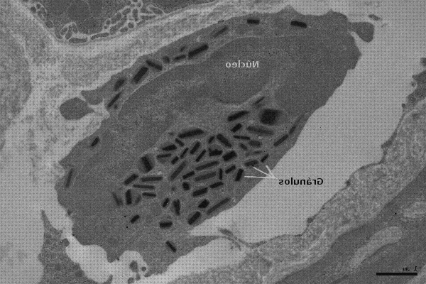 Las mejores optica microscopio optica eosinófilo