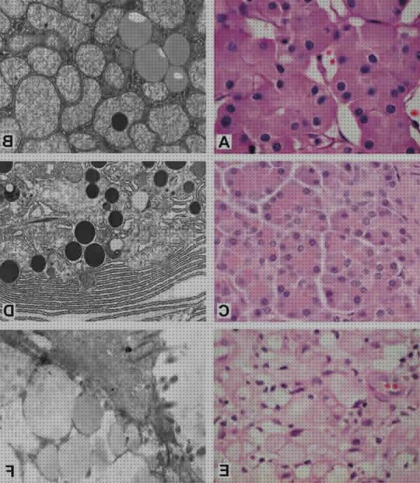 Review de microscopio optica eosinófilo