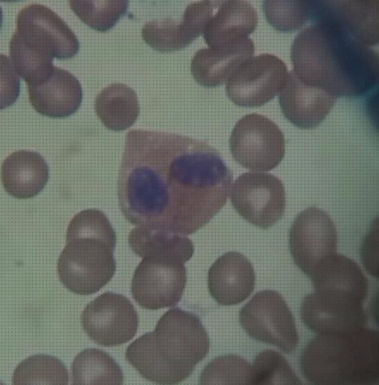 Análisis de los 26 mejores Microscopios Optica Eosinófilo