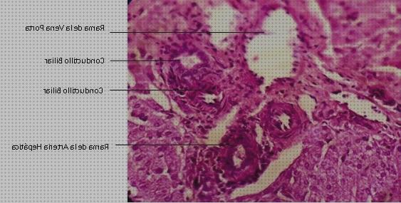 Las mejores microscopio optico arteria