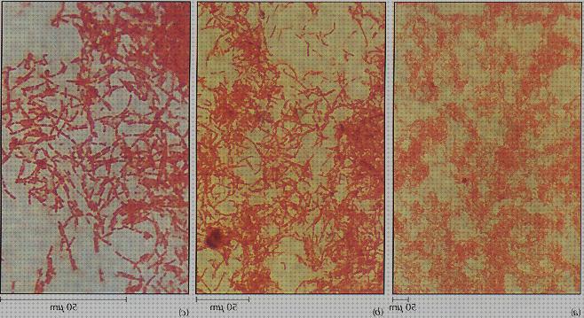 41 Mejores microscopios optico arterias