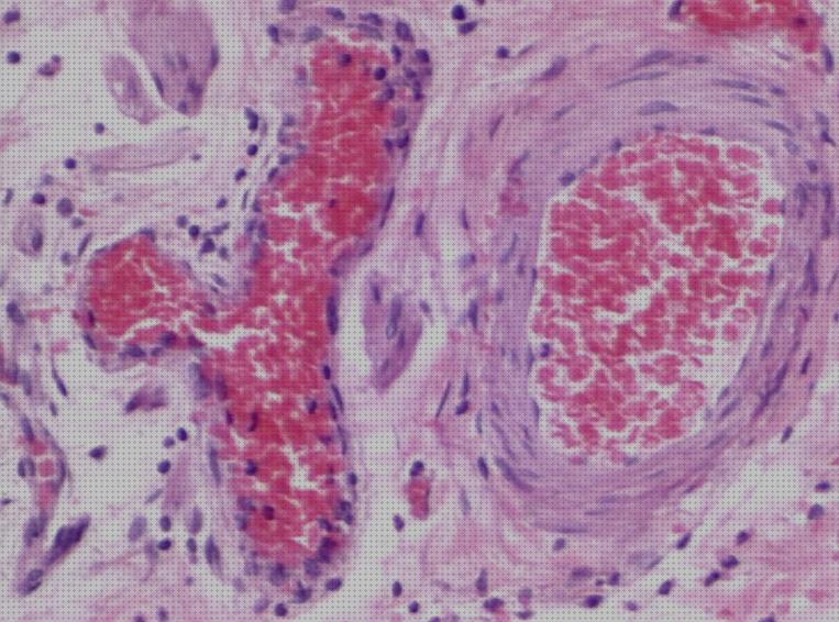 Las mejores marcas de microscopio optico arteria