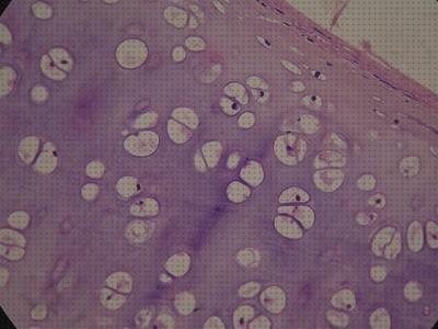 Análisis de los 20 mejores Microscopios Optico Cartilago Fibrosos