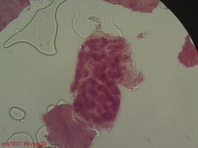 Opiniones de los 12 mejores Microscopios Optico Celula Metafase Glandula