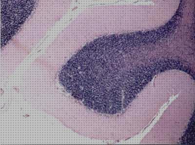 Las mejores ópticos microscopios microscopio optico cerebelo