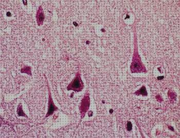 Las mejores ópticos microscopios microscopio optico cerebro