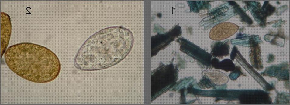 Las mejores marcas de microscopio optico dicrocelium dendriticum