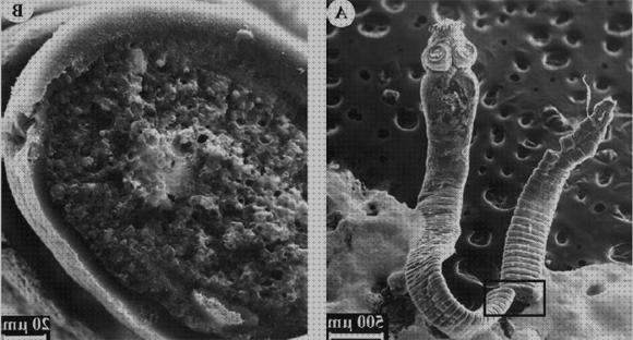 Análisis de los 17 mejores Microscopios Optico Fasciola Hepatica