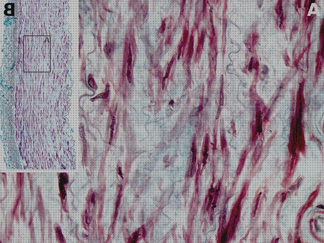 Opiniones de los 26 mejores Microscopios Optico Fibras Elasticas Elásticos