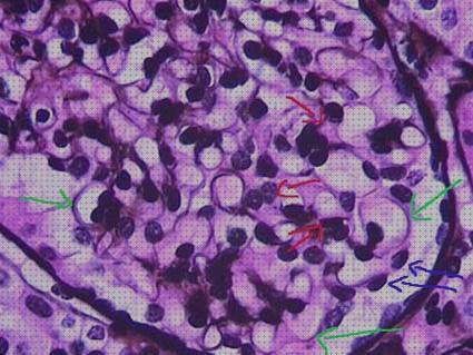 Opiniones de los 26 mejores Microscopios Optico Glomerulo Normales