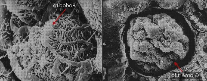 Las mejores glomerulo microscopio optico glomerulo normal