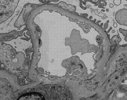 Review de microscopio optico glomerulo normal