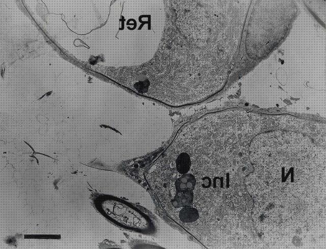 Las mejores microscopio optico inclusion citoplasmatica