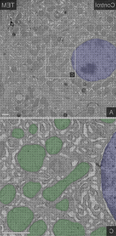 Review de microscopio optico inclusion citoplasmatica