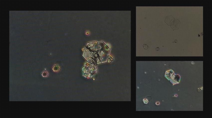 Las mejores marcas de polarizada microscopio optico luz polarizada