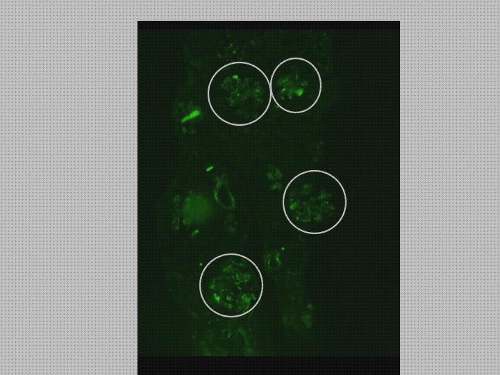 Opiniones de los 17 mejores Microscopios Optico Nefropatia Iga