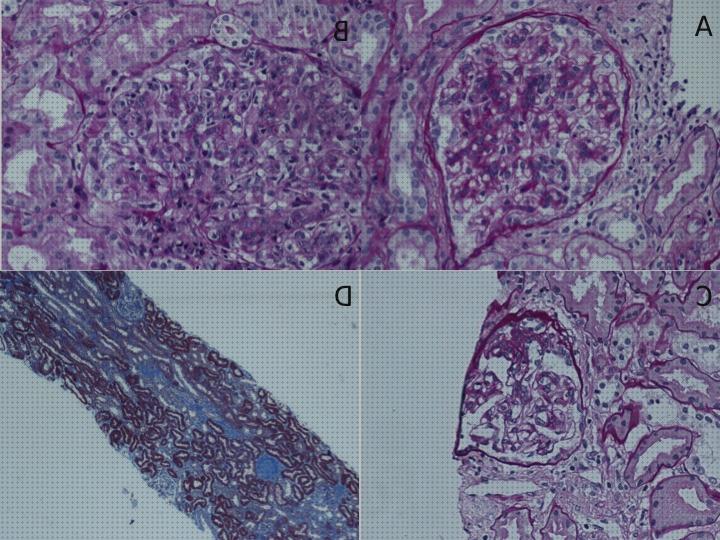 ¿Dónde poder comprar microscopio optico nefropatia iga?