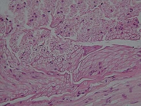 ¿Dónde poder comprar microscopio optico nervio raquideo?