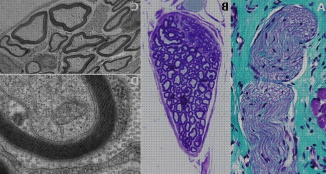 Opiniones de los 21 mejores Microscopios Optico Nervios Raquideo