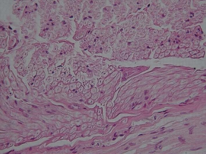 Las mejores microscopio optico nervio raquideo