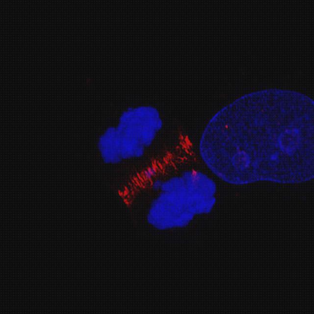 ¿Dónde poder comprar microscopio optico nis?