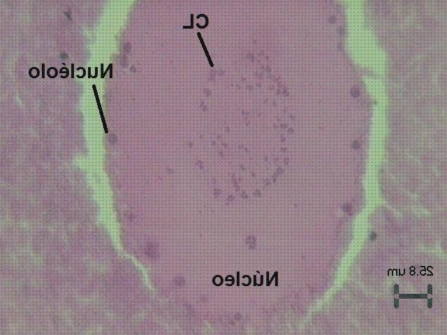 Las mejores marcas de nucleos microscopio electronico Más sobre microscopio electronico mitocondrias Más sobre microscopio stm microscopio óptico nucleos