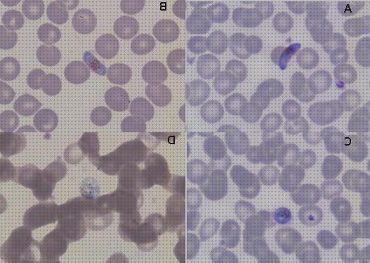 Mejores 27 microscopios optico plasmodium bajo análisis