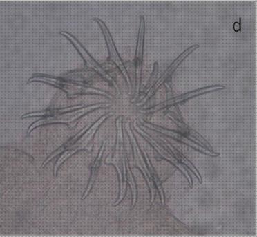 Opiniones de los 20 mejores Microscopios Optico Tenia Solium