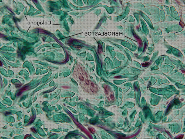 ¿Dónde poder comprar conectivo microscopio electrónico conectivo denso?