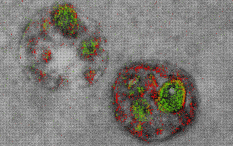 Las mejores marcas de microscopio electronico moco