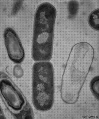 Las mejores marcas de microscopio electronico moléculas